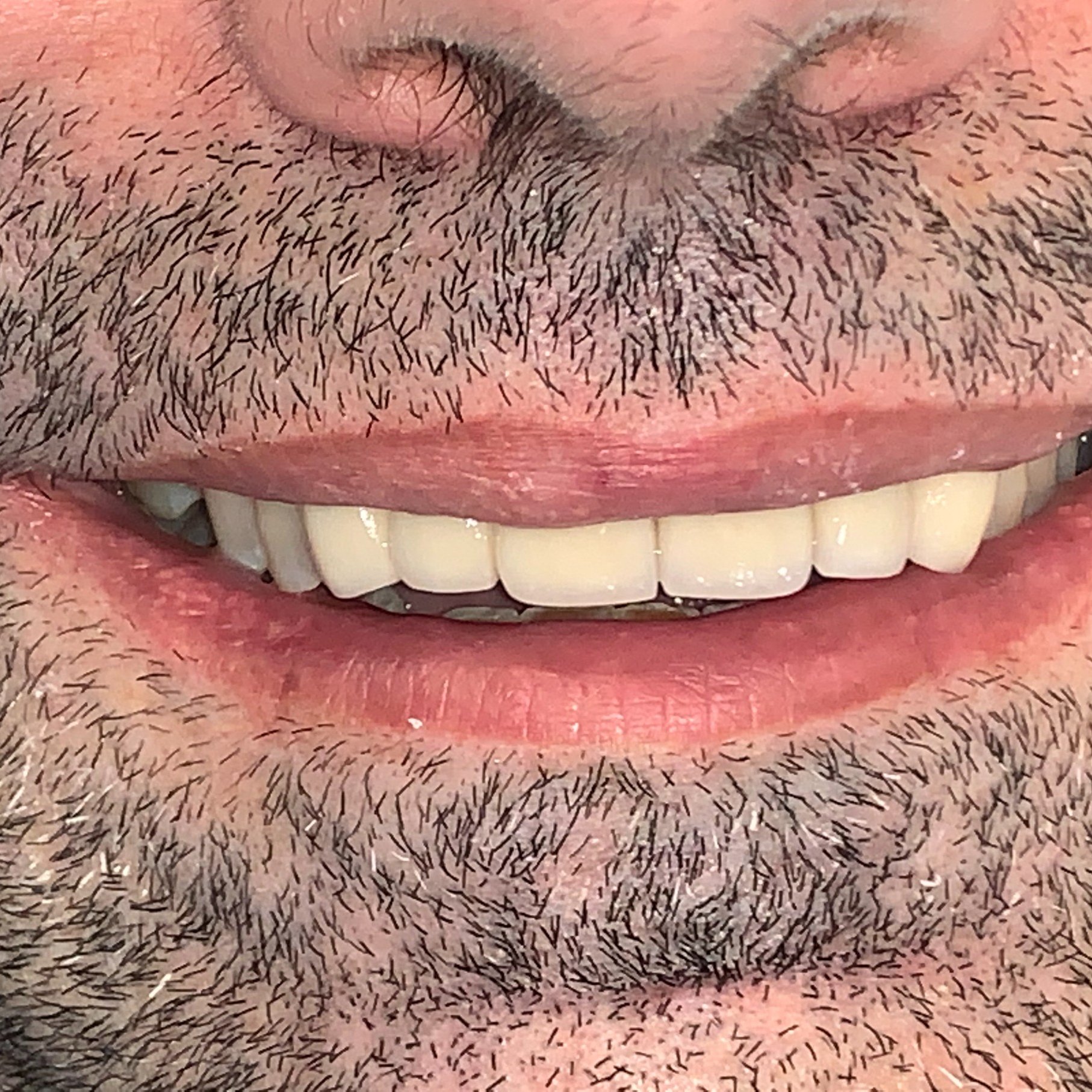 4F982883-C35A-4213-B948-924C2D2FEBD6