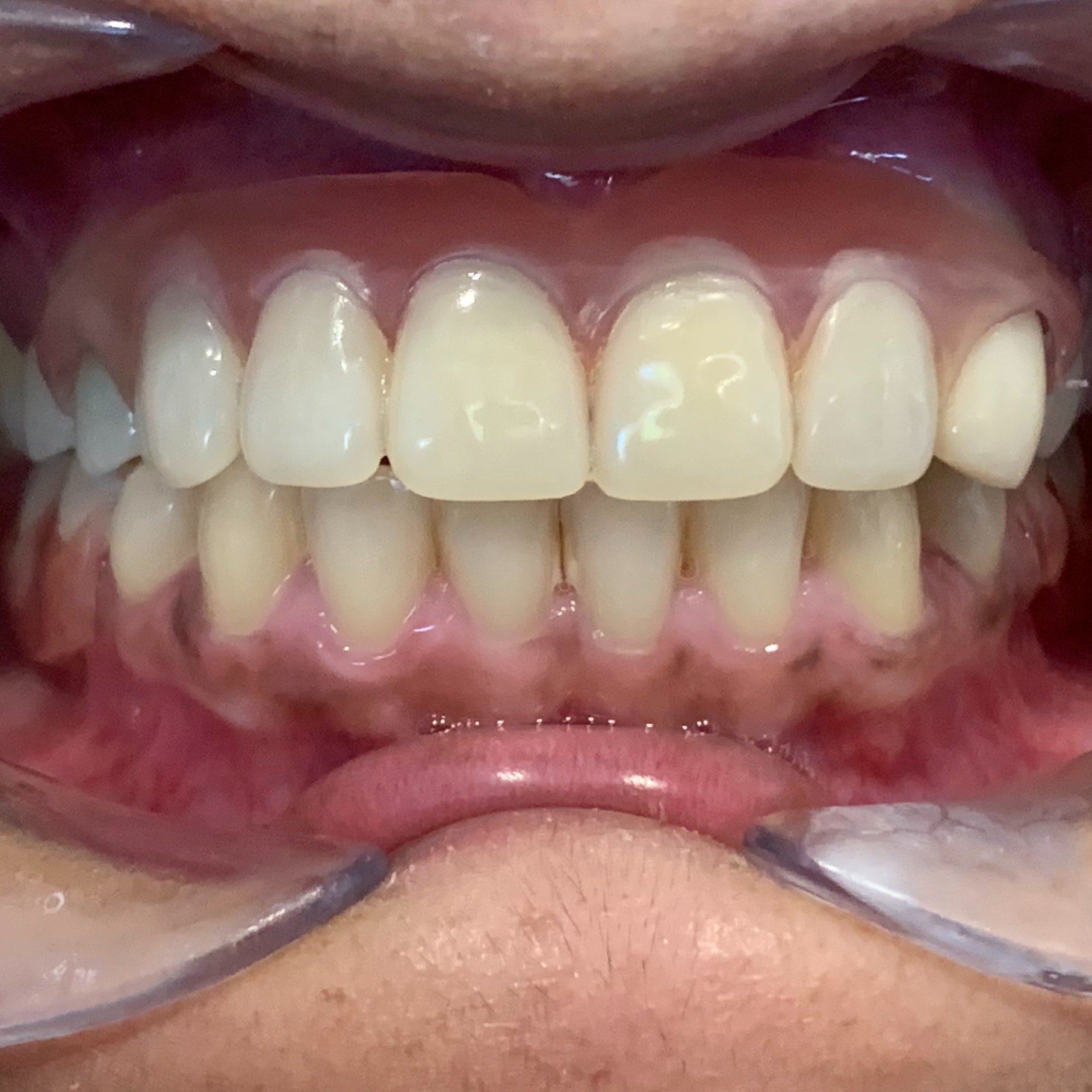 8E0C0BFA-7416-4A7A-AE75-CB5699850E93