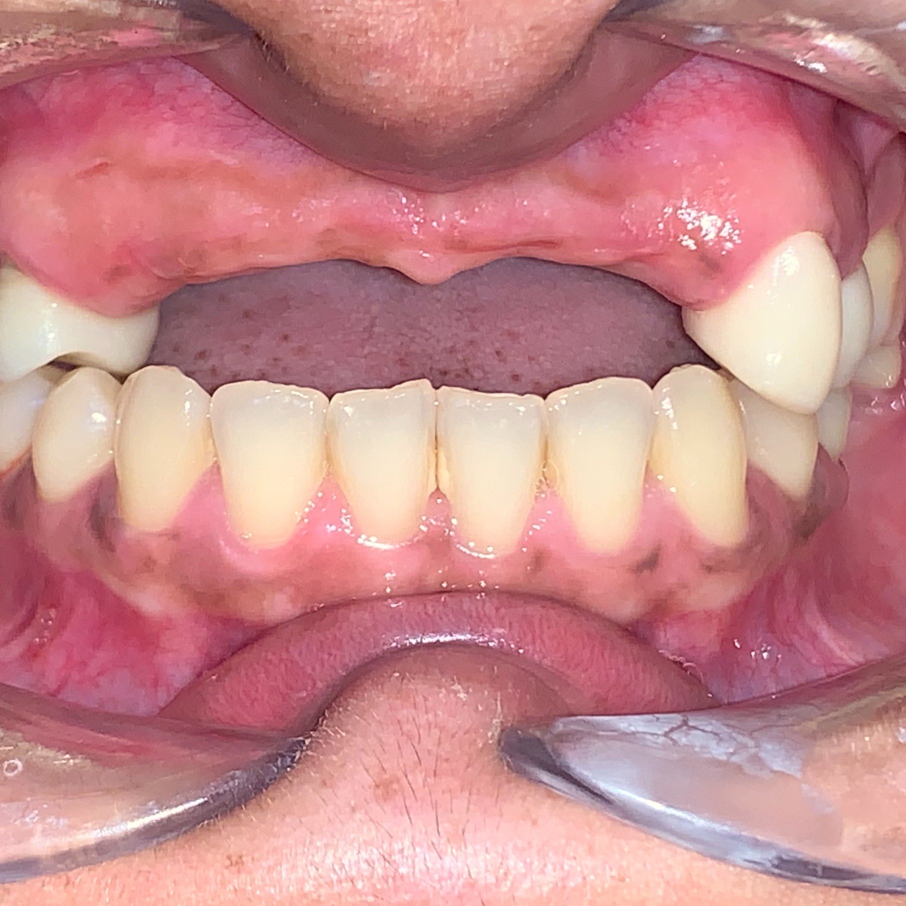 F49E57ED-9B9D-4F02-AF22-4051562CAACD